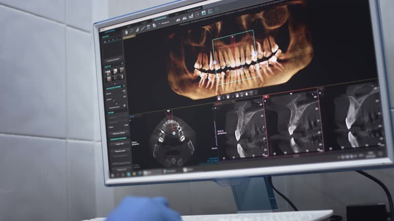 TMJ/TMD Treatment in Gleason, TN